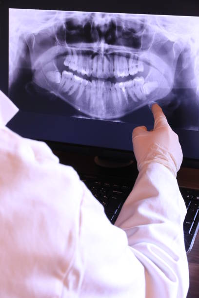 Best Emergency Broken Tooth Repair in Murfreesboro, TN